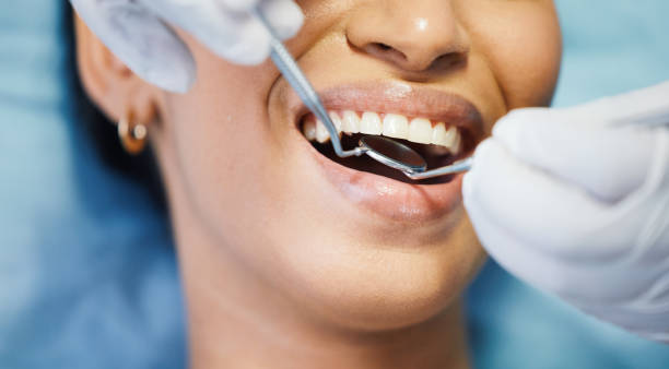 Best Holiday Emergency Dentist in Silverdale, WA